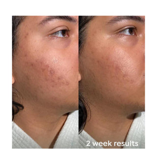 EQUATE SCAR GEL SKIN CARE FOR SCARS 1.76 50G