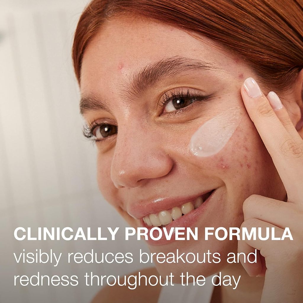 Neutrogena Stubborn Acne with Benzoyl Peroxide (25% Micronized BPO) 56g