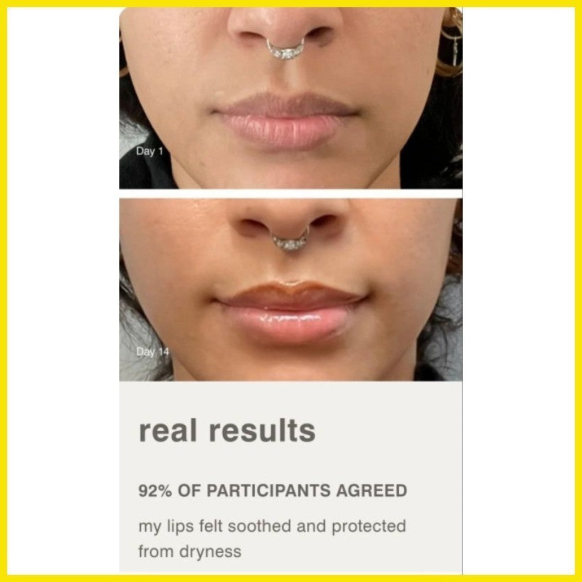 Rhode Peptide Lip Treatment